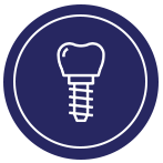 Dental Implants | Scarborough Dentist | Bellesmere Dental Office